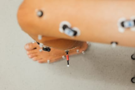 «Antennas» on the leg: I'm not being remote-controlled, I'm being analysed.
