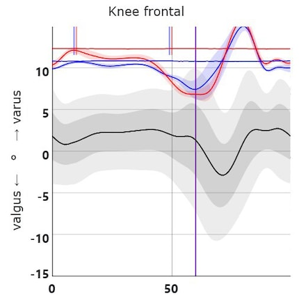 My knees point slightly inwards, my shins bend outwards.
