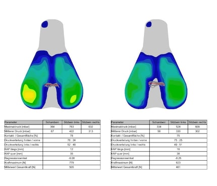 Visualisation of the pressure change after the fitting.