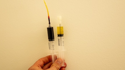 The transparent plasma on the right, waste blood on the left.