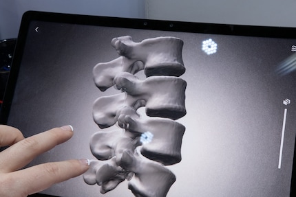 The nubia Pad 3D II has an improved 3D display, for example for bone models.