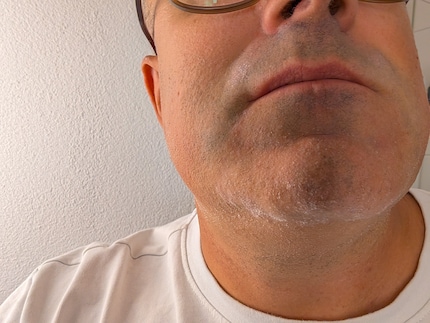 Dry skin when dry shaving – not for me.