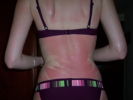 Die Kehrseite des Sommers. Ich war jung und dumm.