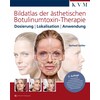 Image atlas of aesthetic botulinum toxin therapy (German)